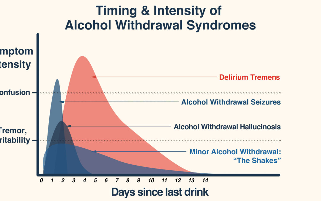 Alcohol Detox Guide: How Long Do Delirium Tremens (DTs) Last?