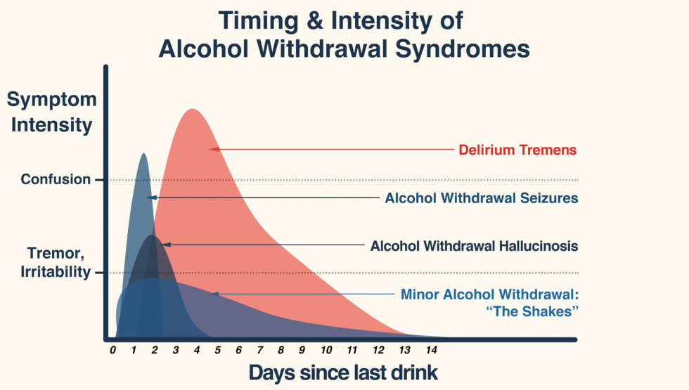 alcohol-detox-guide-how-long-do-delirium-tremens-dts-last