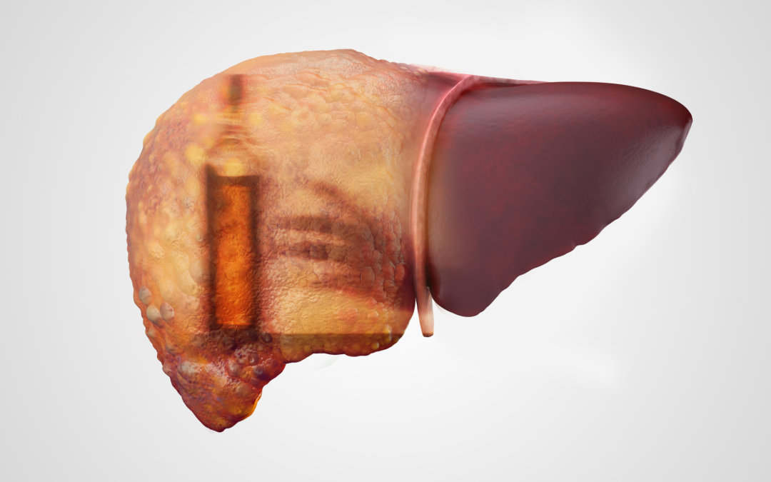 What Happens to Your Liver When You Stop Drinking Alcohol?